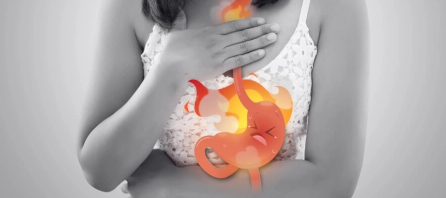 mulher com sintomas de queimação estomacal e ilustração do estômago em chamas sobreposta